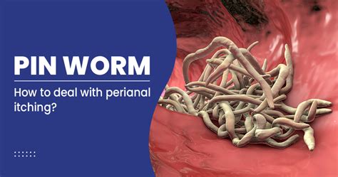The male worm is rarely seen because it remains inside the intestine. . How many pinworms are inside me